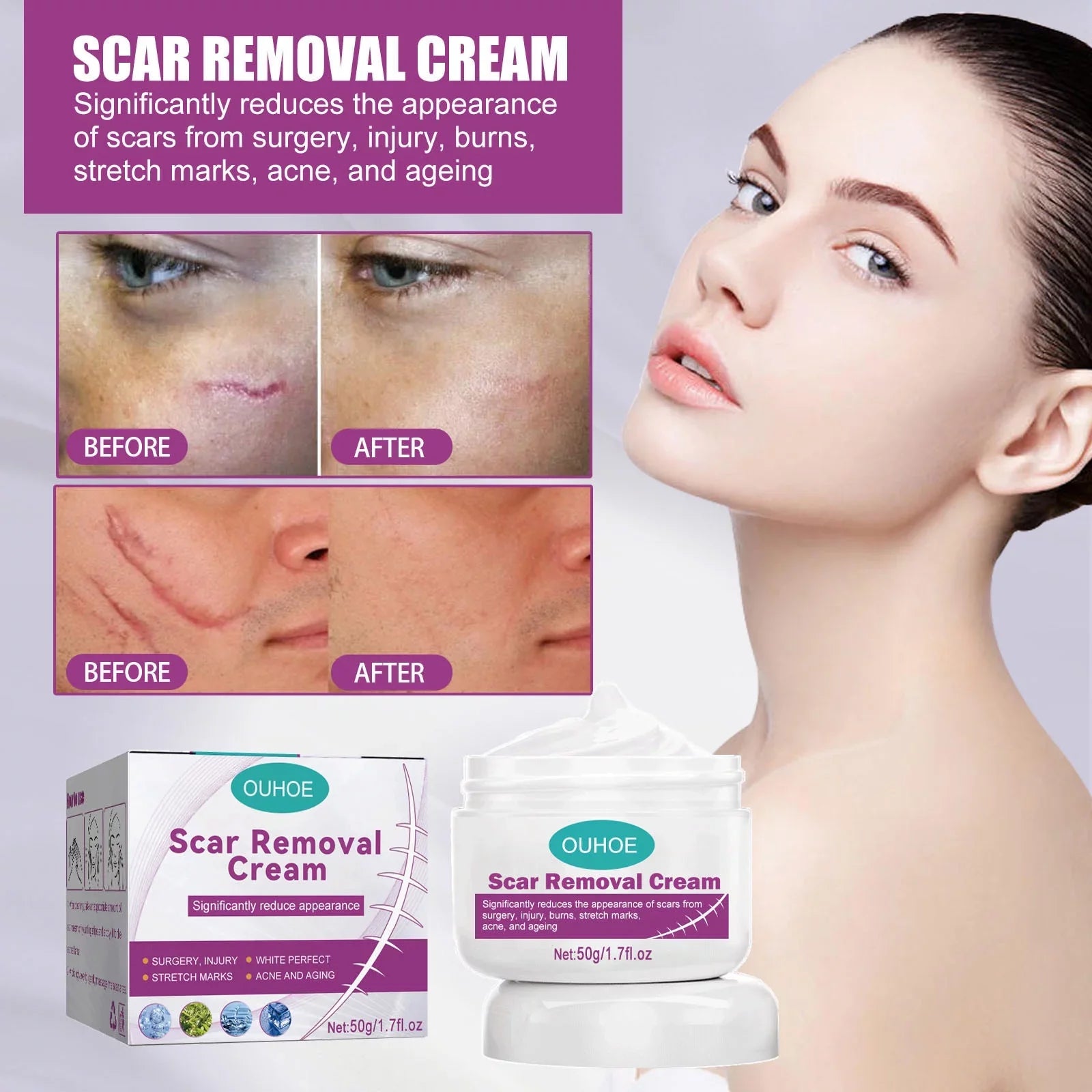 2PCS Scar Removal Cream Scar Repair Cream Scar Removal and Skin Repair 50ml