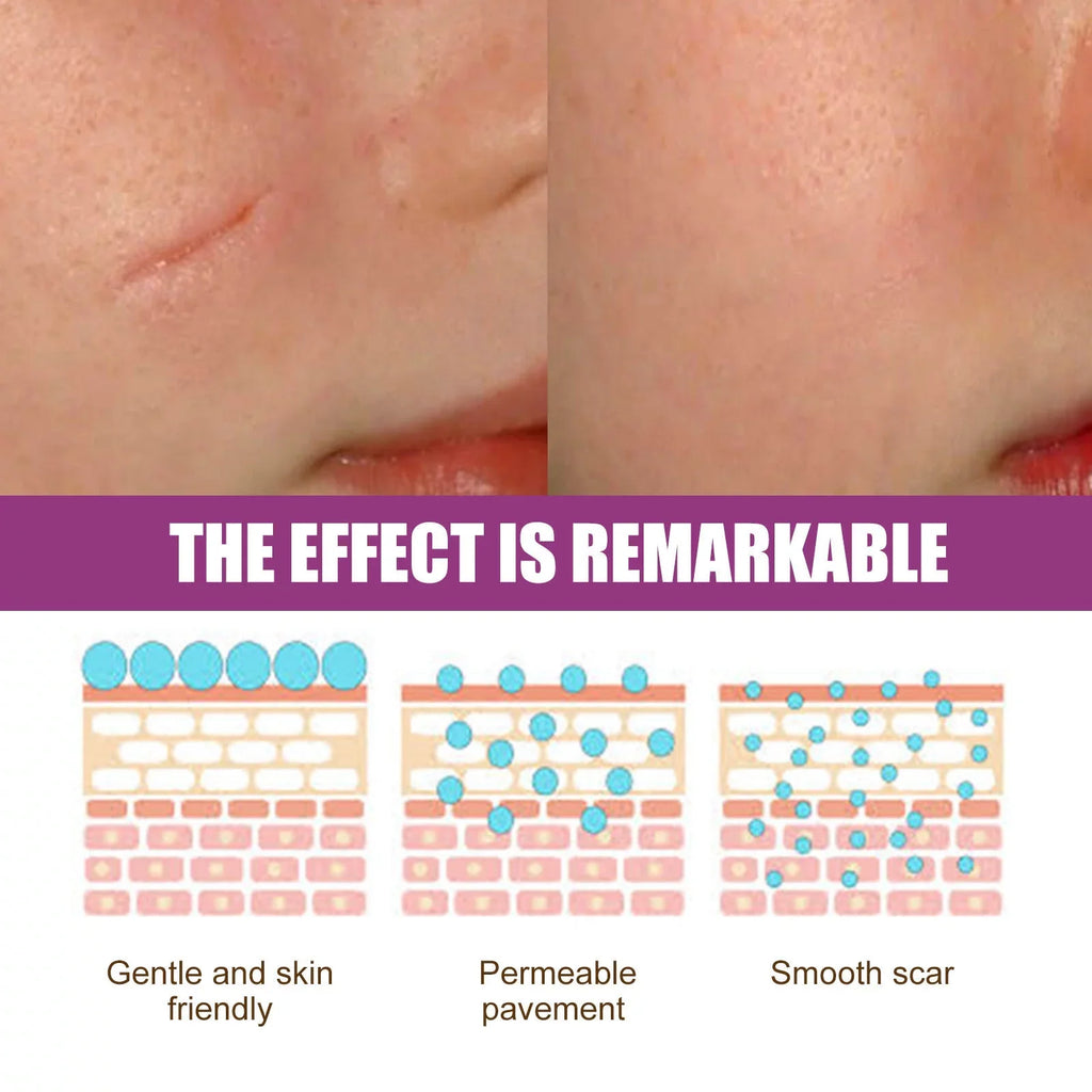 2PCS Scar Removal Cream Scar Repair Cream Scar Removal and Skin Repair 50ml