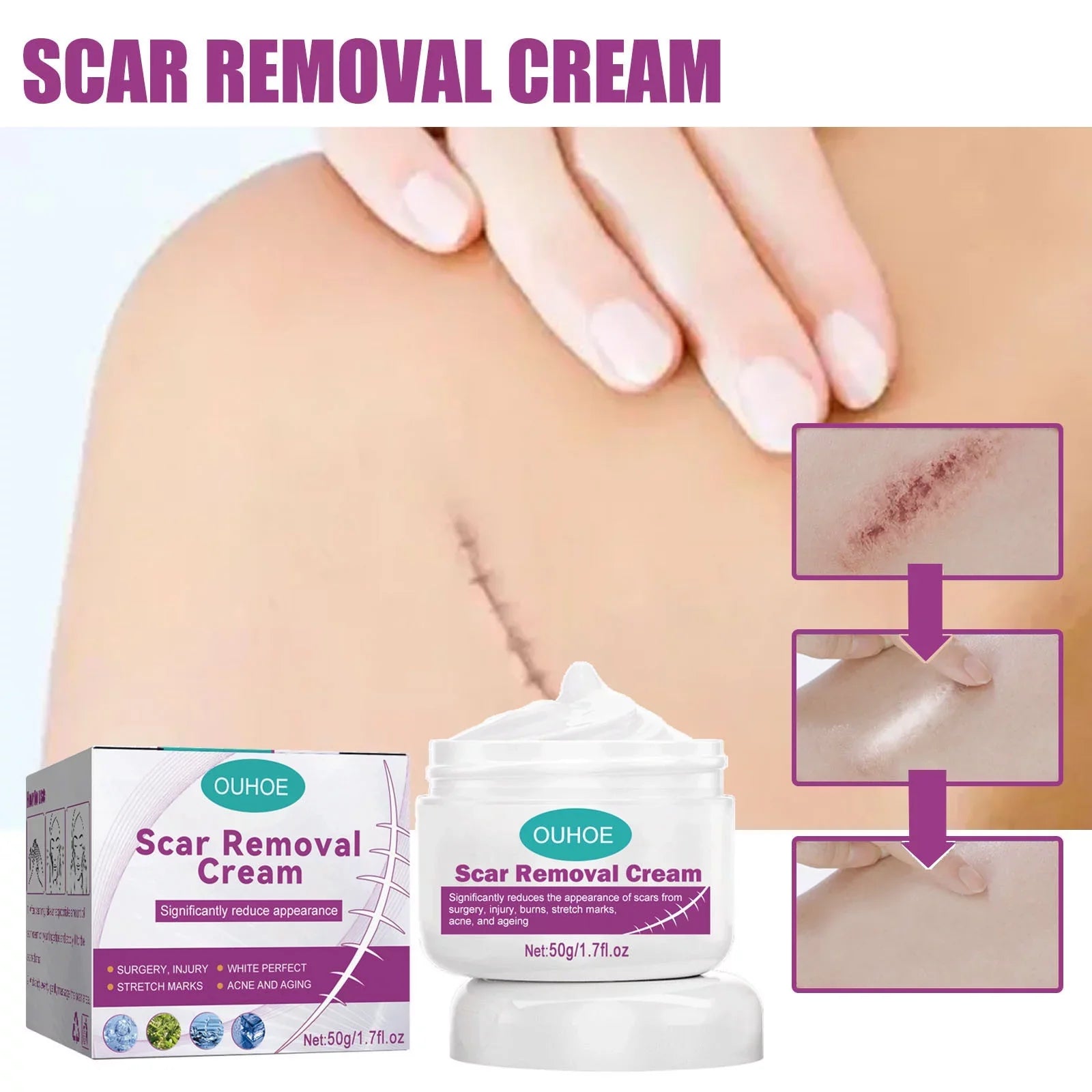 2PCS Scar Removal Cream Scar Repair Cream Scar Removal and Skin Repair 50ml