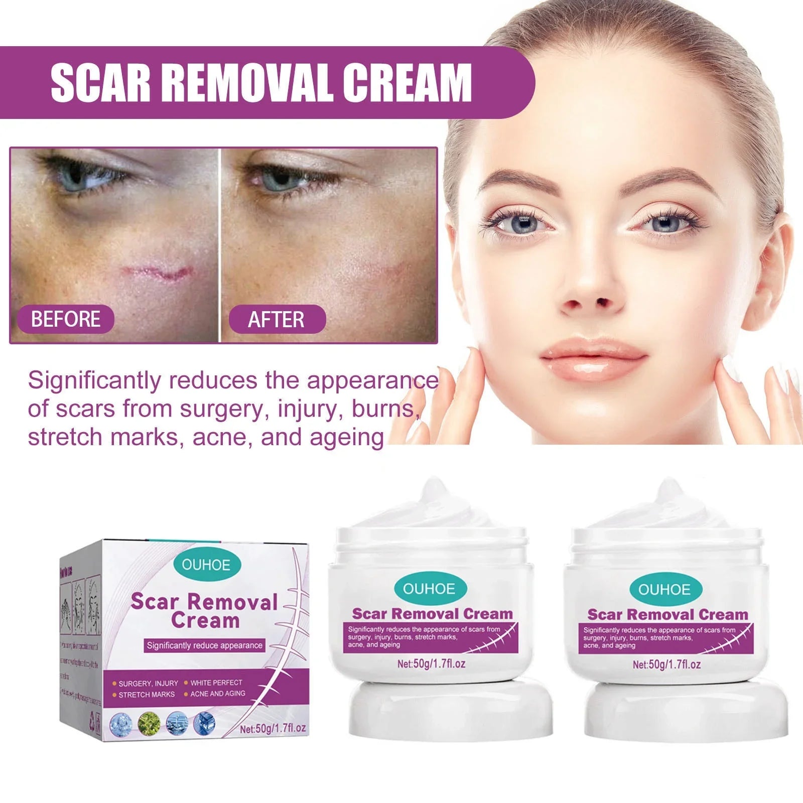 2PCS Scar Removal Cream Scar Repair Cream Scar Removal and Skin Repair 50ml