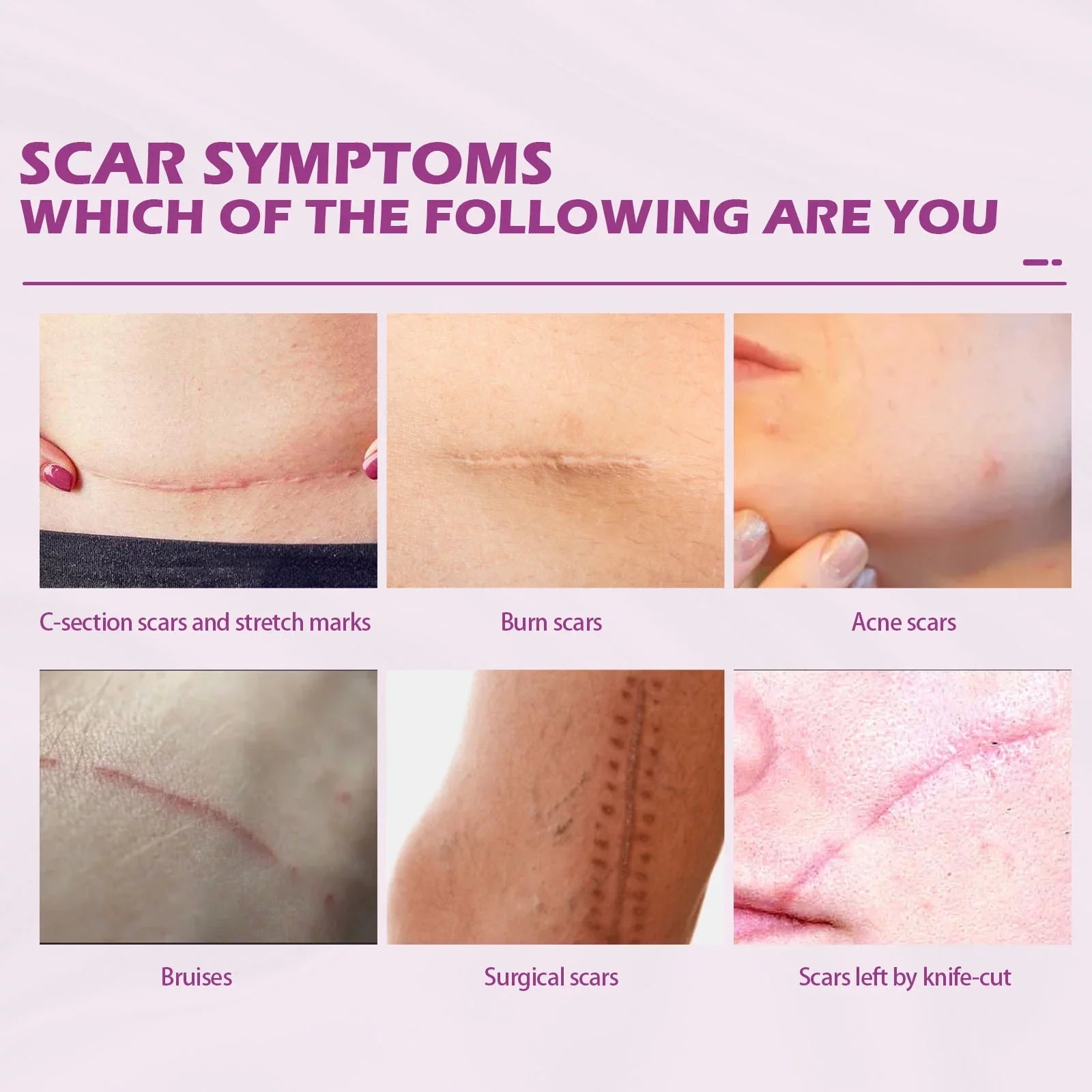 2PCS Scar Removal Cream Scar Repair Cream Scar Removal and Skin Repair 50ml